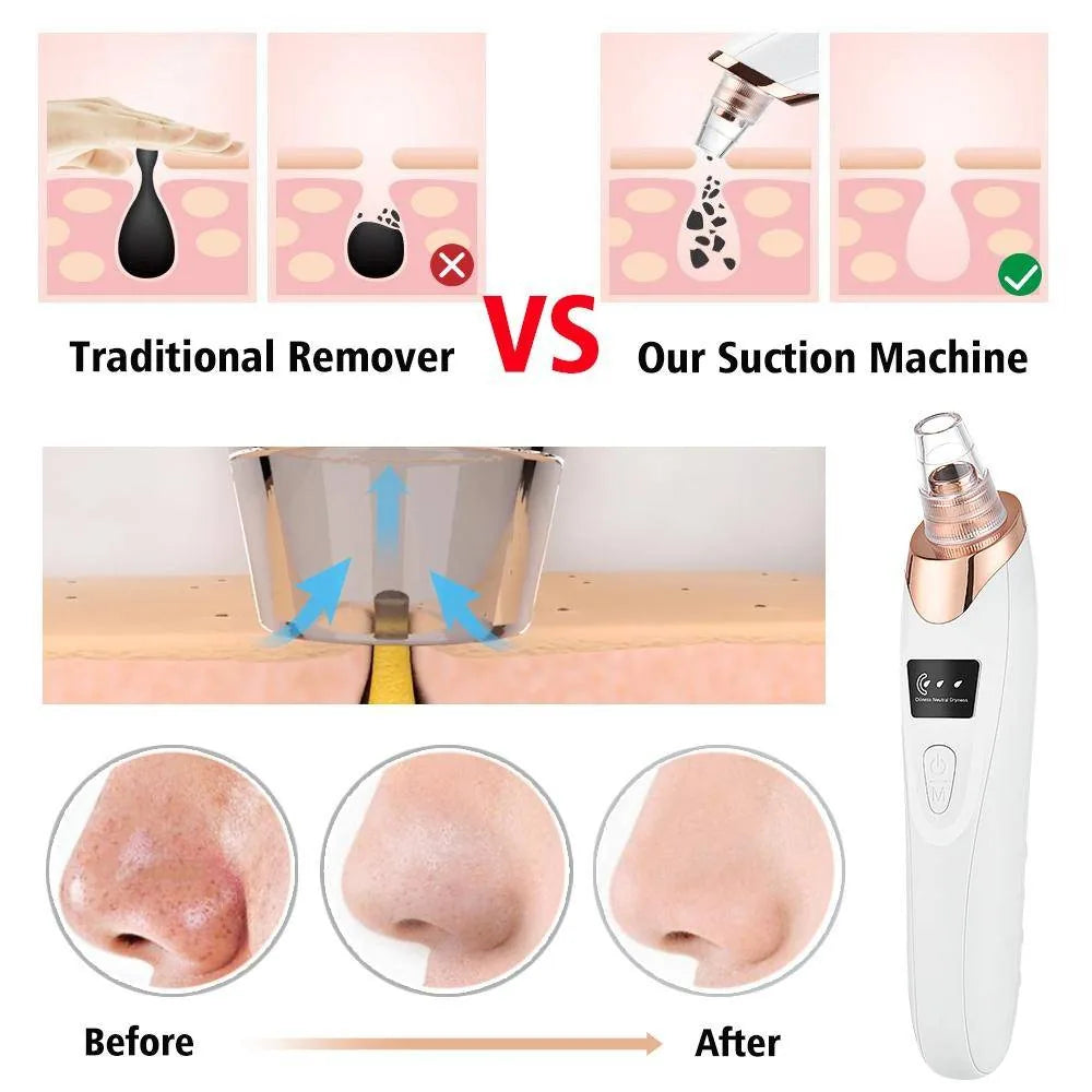Blackhead Suction Remover Portable Pore Cleaner with LED Display and Multiple Suction Levels